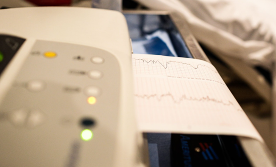 Love Your Heart: EKG Testing for Early Detection of Heart Conditions